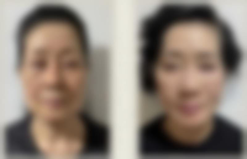 焦作丽人医疗美容诊所求美者反馈