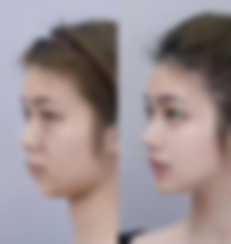 韩国苹果妇科医院（江南店）来院路线