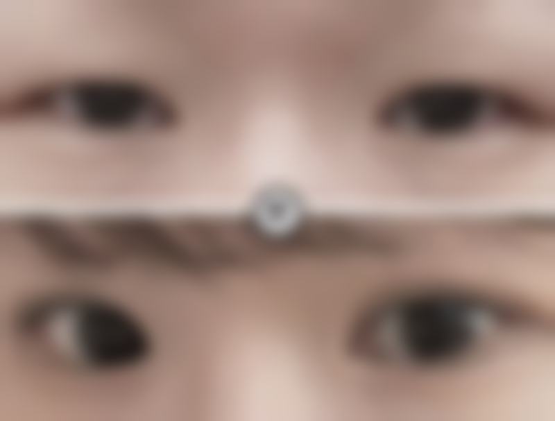 杭州西美医疗美容诊所求美者反馈