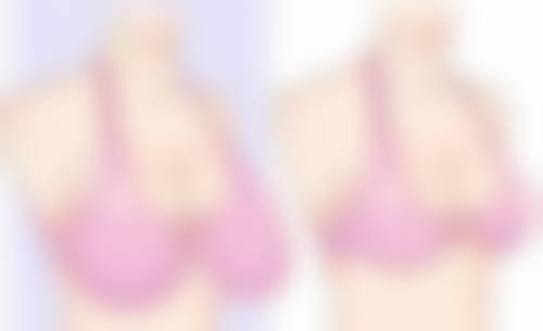 呼和浩特五洲整形医院求美者反馈