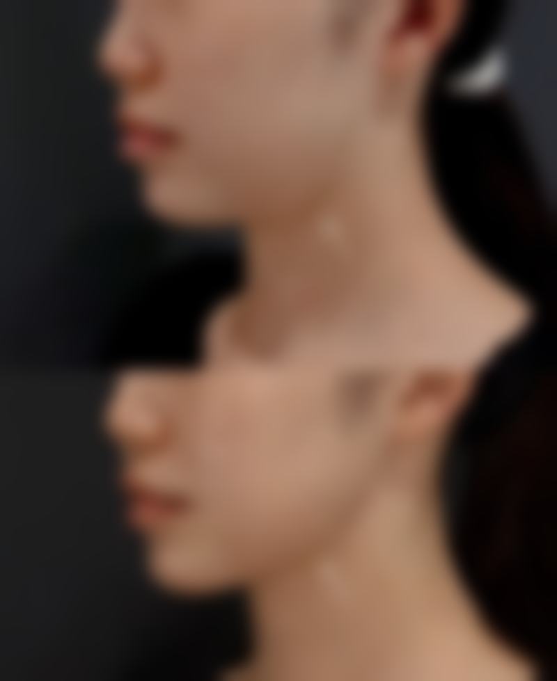 长沙新发现医疗美容门诊部求美者反馈