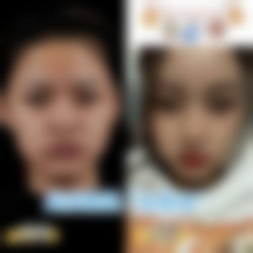 上海余天成医疗美容门诊部求美者反馈