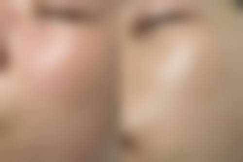 杭州芯瑞晶医疗美容诊所求美者反馈