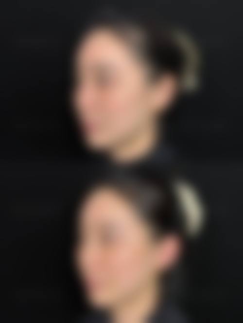 泉州弗丽嘉（原亿露美）医疗美容门诊部价格收费