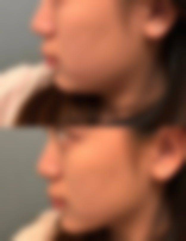 杭州芯瑞晶医疗美容诊所价格收费