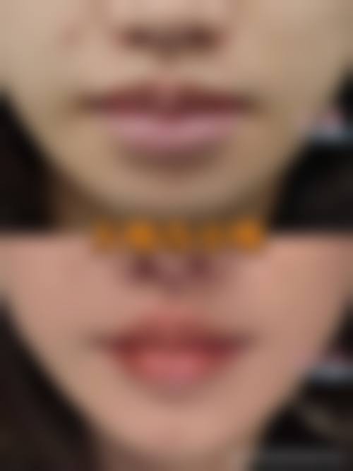 宁波鄞州维洛纳茱丽整形医院求美者反馈