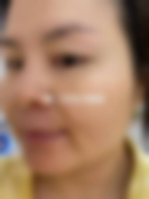 石神井公园站前皮肤科价格收费