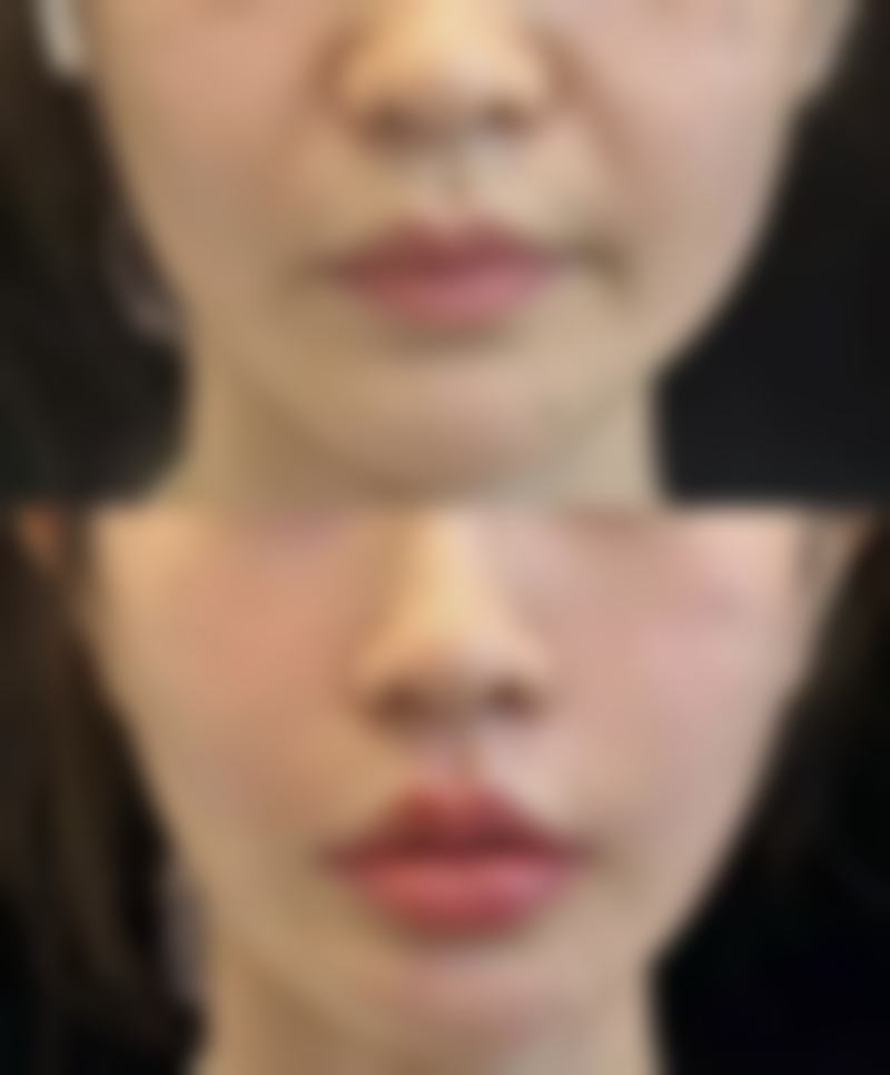 北京伟力嘉美信医疗美容医院特色项目及技术优势