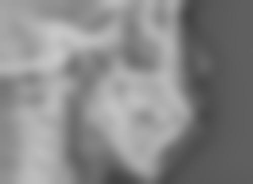 深圳南方激光美容专科门诊特色项目及技术优势