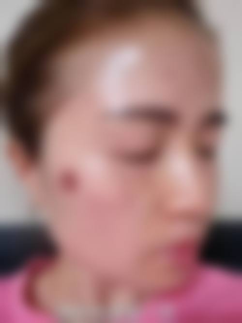 秦瑞雨医师正规执业：合规医美让就诊更安心