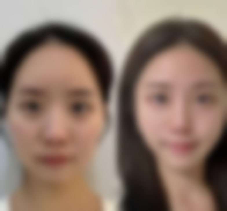 西安泊妍整形医院价格收费