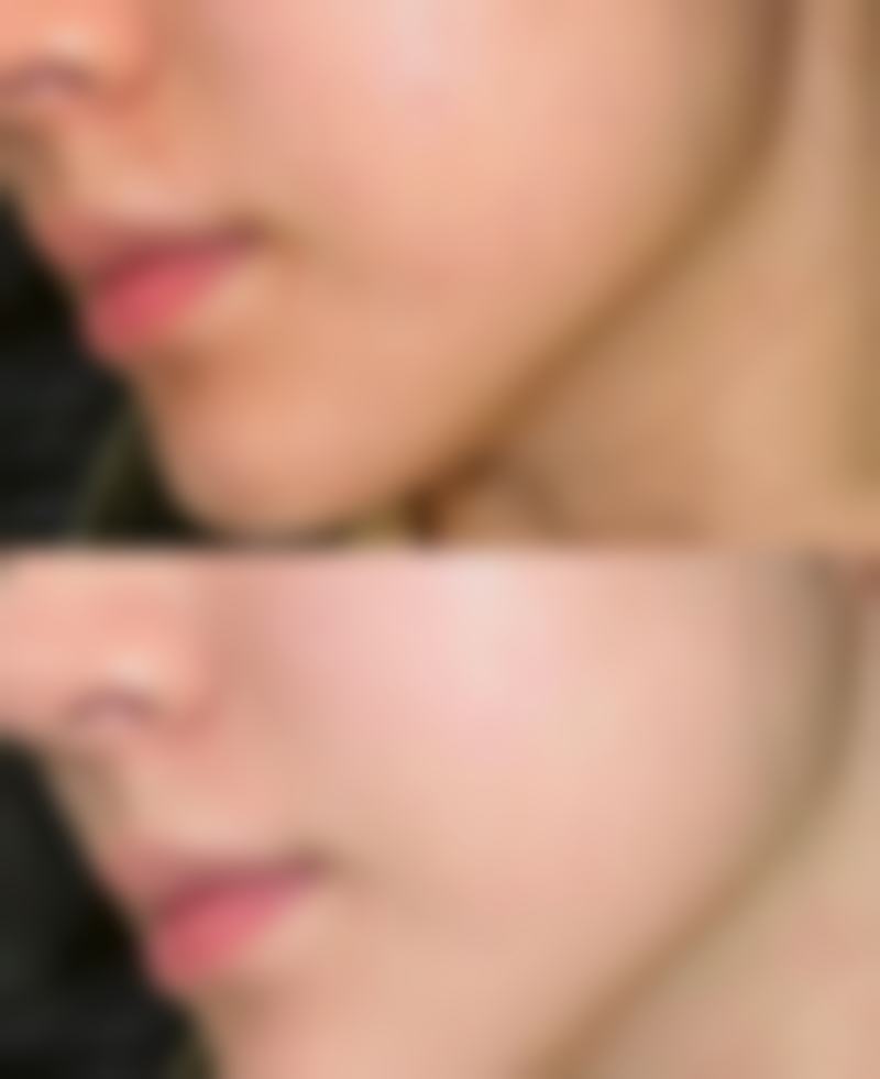 北京贝拉整形医院求美者反馈