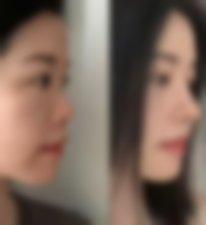 温州粉范整形美容医院求美者反馈