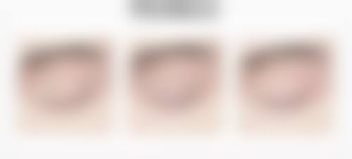 广州十三伊颜医疗美容诊所特色项目及技术优势