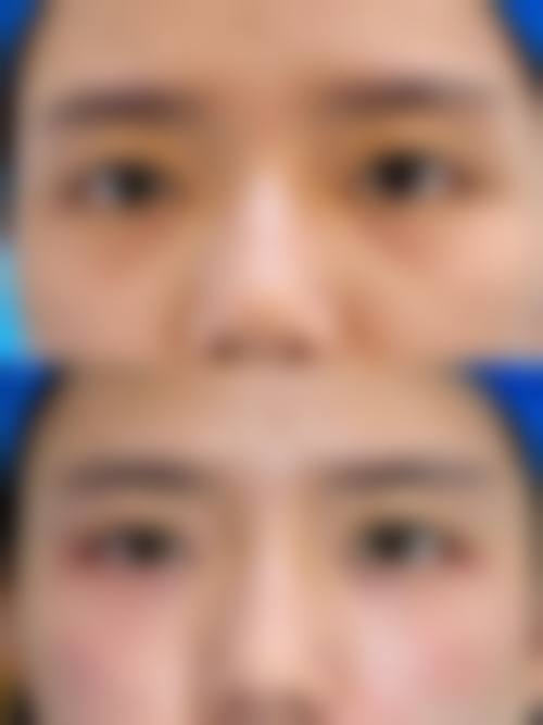 张玉医生：五官整形的艺术化美学设计