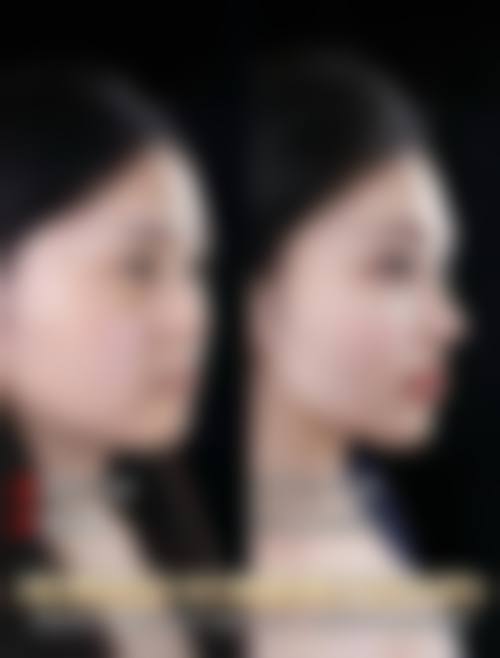 西安天嗣医疗美容门诊部求美者反馈