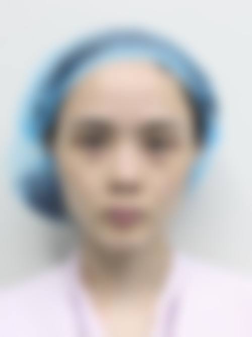 张玉医生：依托正规平台的高品质医美体验