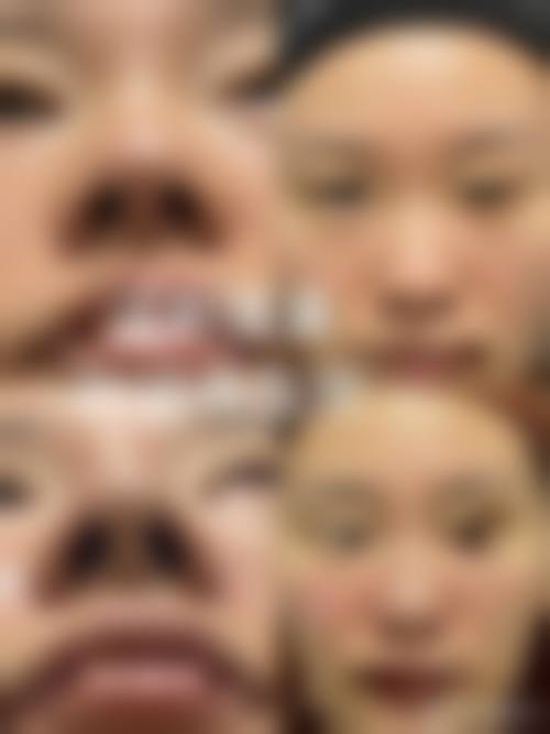 李钟喜院长的行医准则：以求美者需求为核心的舒适医美