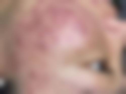 宣威市中医医院求美者反馈