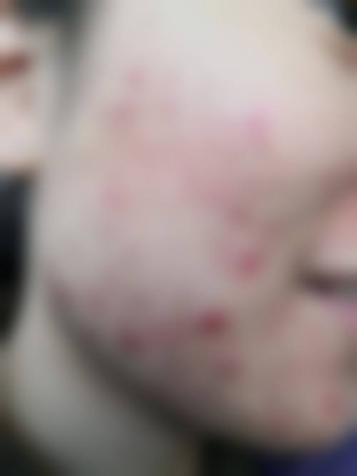 宣威市中医医院特色项目及技术优势