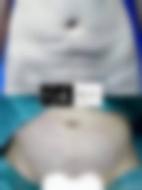 张玉医生：合理定价与便捷就诊渠道