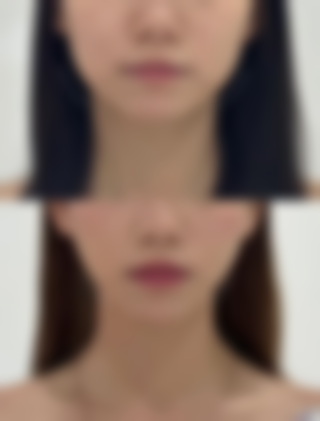 北京孙便友疤康诊所特色项目及技术优势