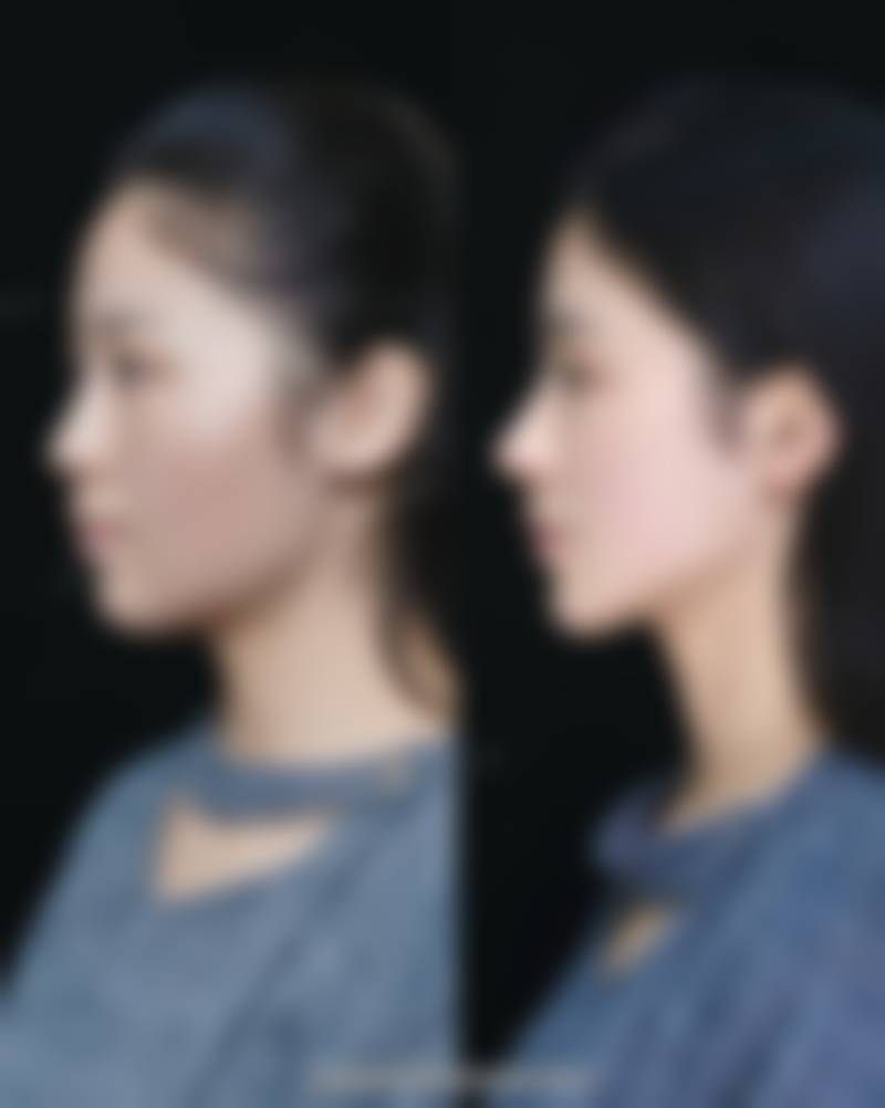 绍兴伊美尔医疗美容医院特色项目及技术优势