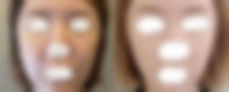 攀枝花花一棠医学美容诊所求美者反馈