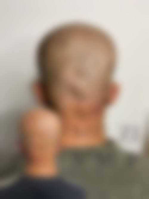 上海科发源植发整形医院特色项目及技术优势