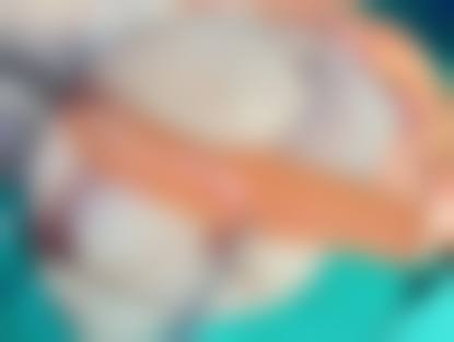 无锡瑞淇医疗美容门诊部价格收费