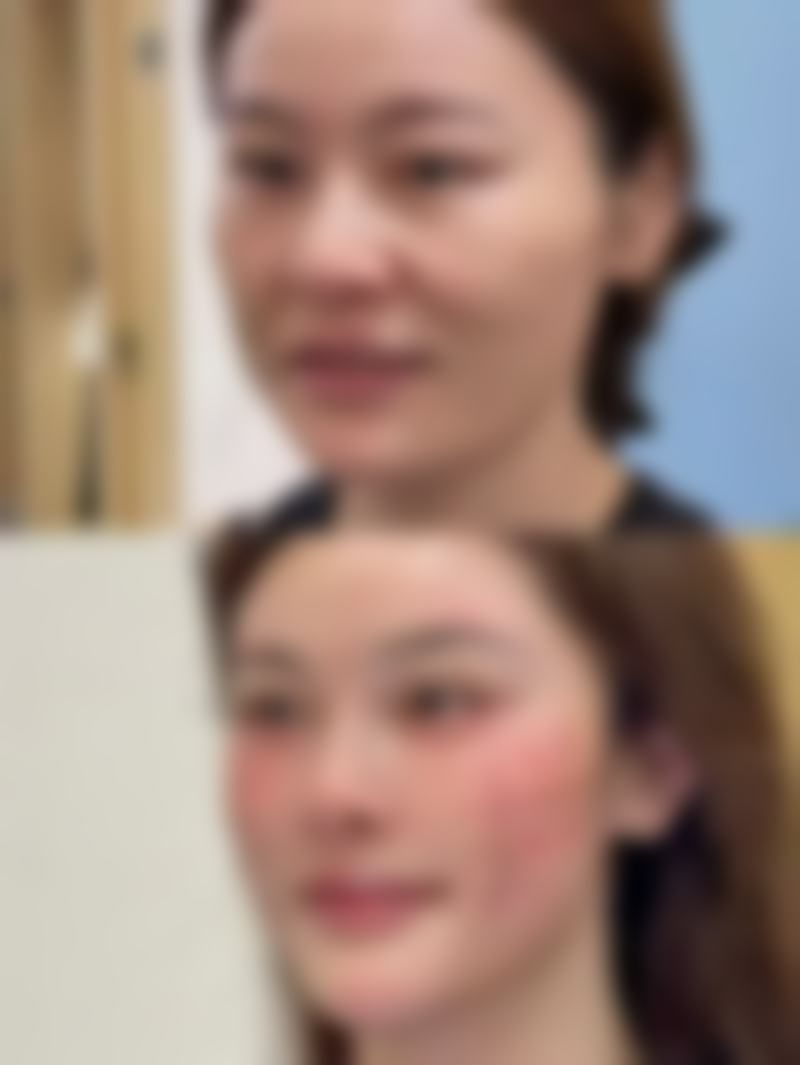 深圳欧亚美创医疗美容求美者反馈