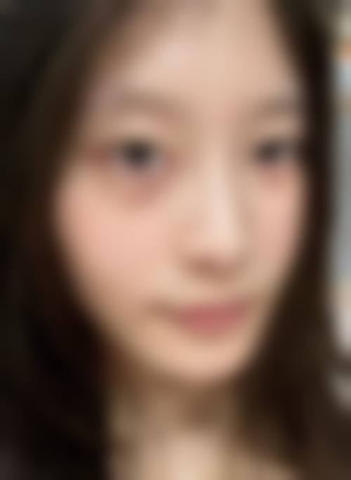 惠焕利医师：践行以患者为中 心的服务理念