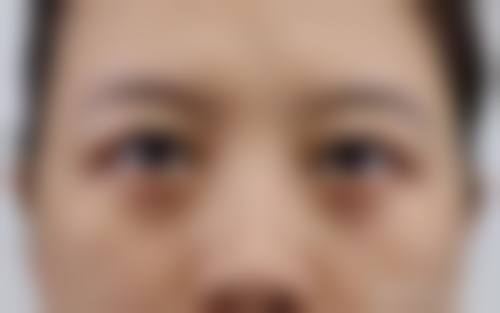 贵阳云岩雪雅医院求美者反馈