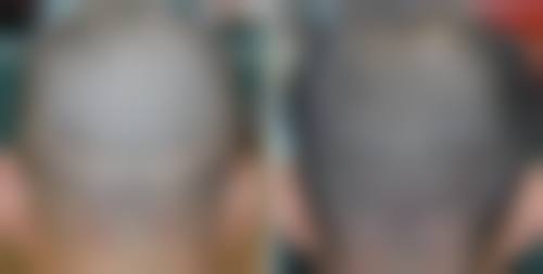 黄兆全主治医师的诊疗服务特色