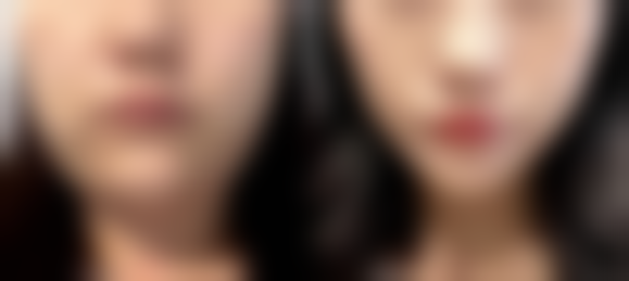 南京玄武贝缇医疗美容整形诊所价格收费