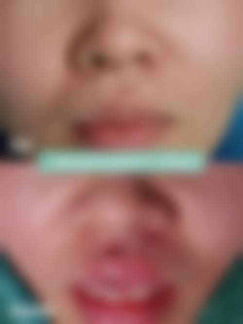 洛阳市中 心医院求美者反馈