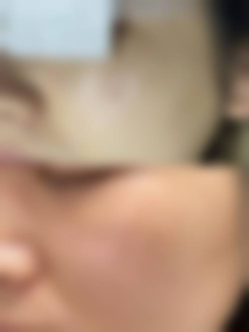 李敏锡医生的技术迭代与学术衔接