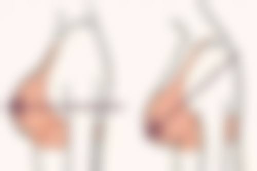 遂宁兴尚美医疗美容门诊部求美者反馈