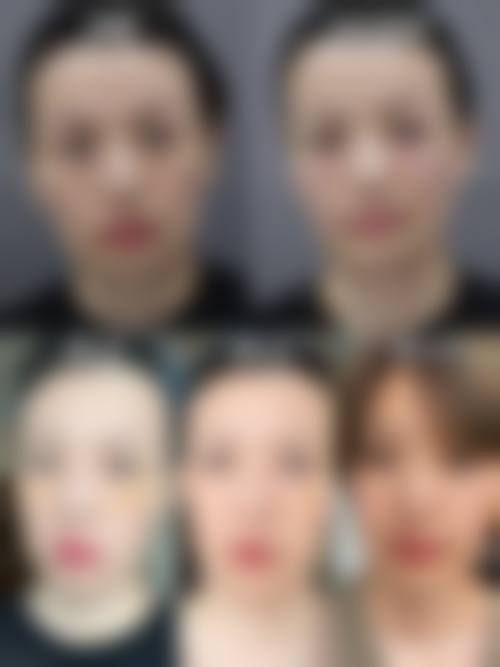 中山越华医疗美容诊所求美者反馈