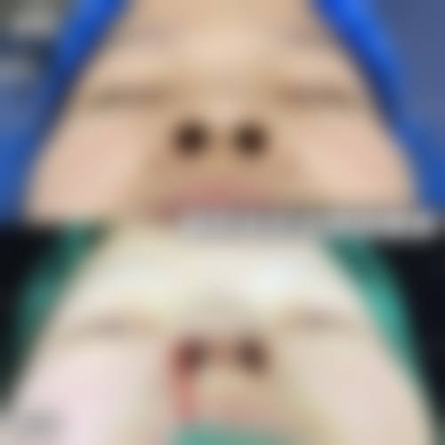 四川巴中知意整形美容医院来院路线