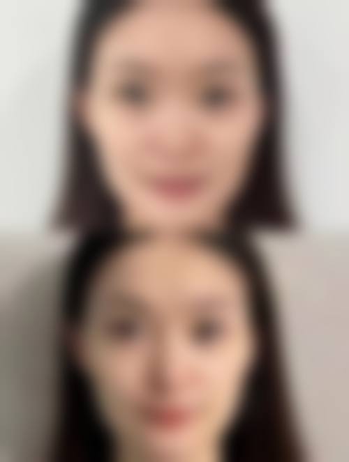安心变得更美，选择韩国欧娜尔整形外科与李智妍医师