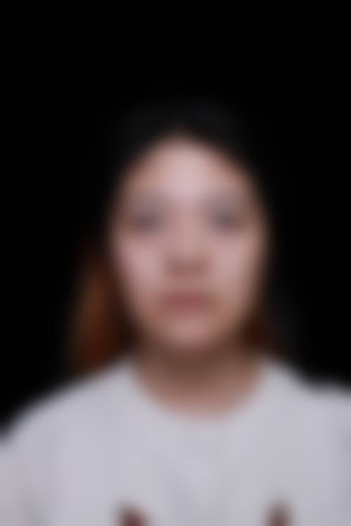 上海美漾整形医院求美者反馈