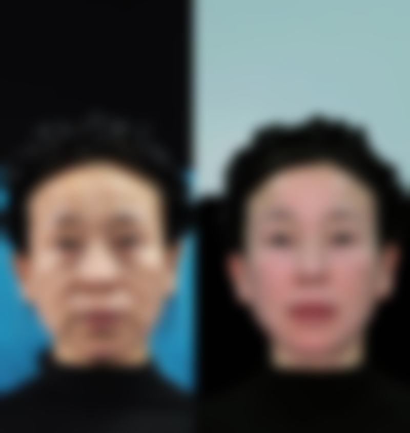 佛山宝肌医疗美容诊所求美者反馈