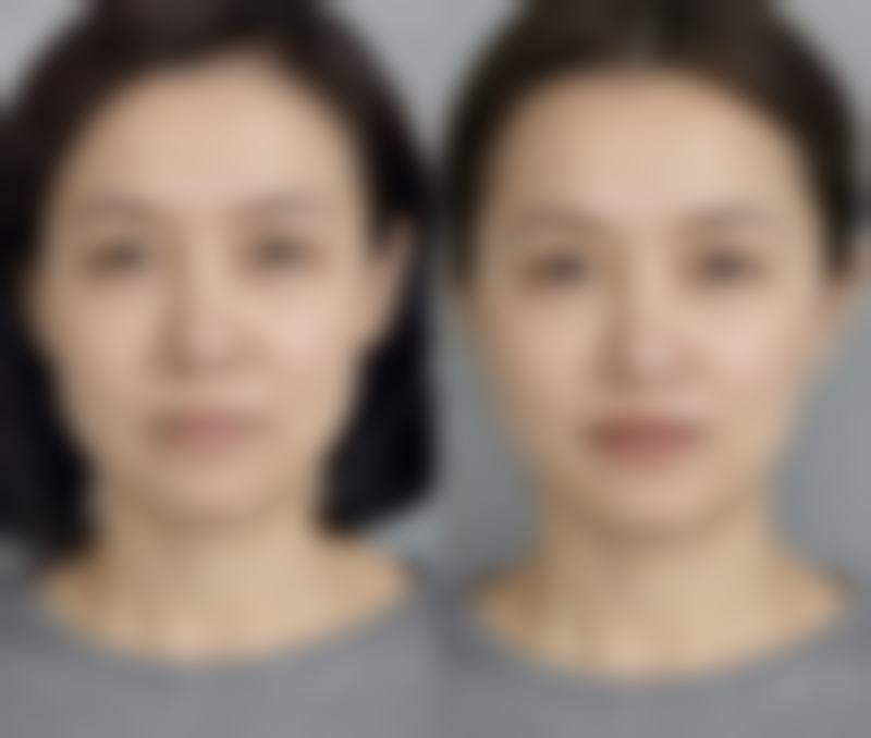 乌鲁木齐世纪亚太整形医院求美者反馈