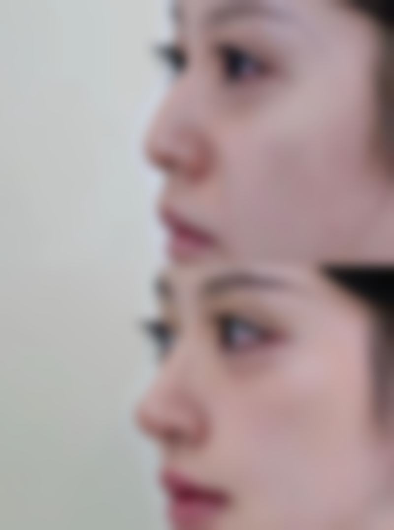 成都美成齿科（锦江门诊）价格收费