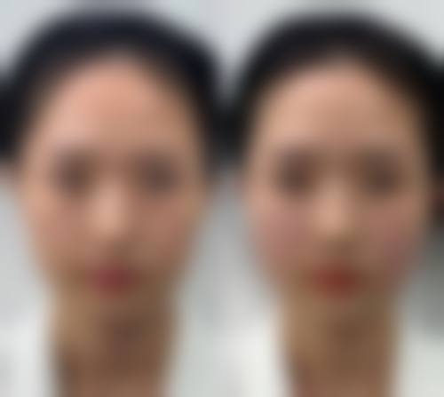 西安瑞丽整形美容医院求美者反馈