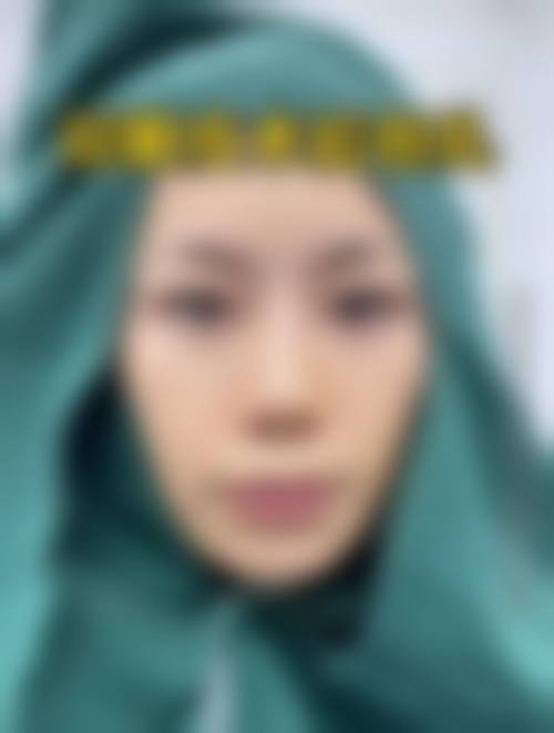 北京渡蓝思整形医院求美者反馈