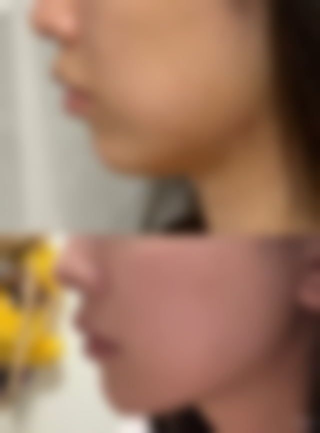 沈阳金皇后医疗美容医院特色项目及技术优势
