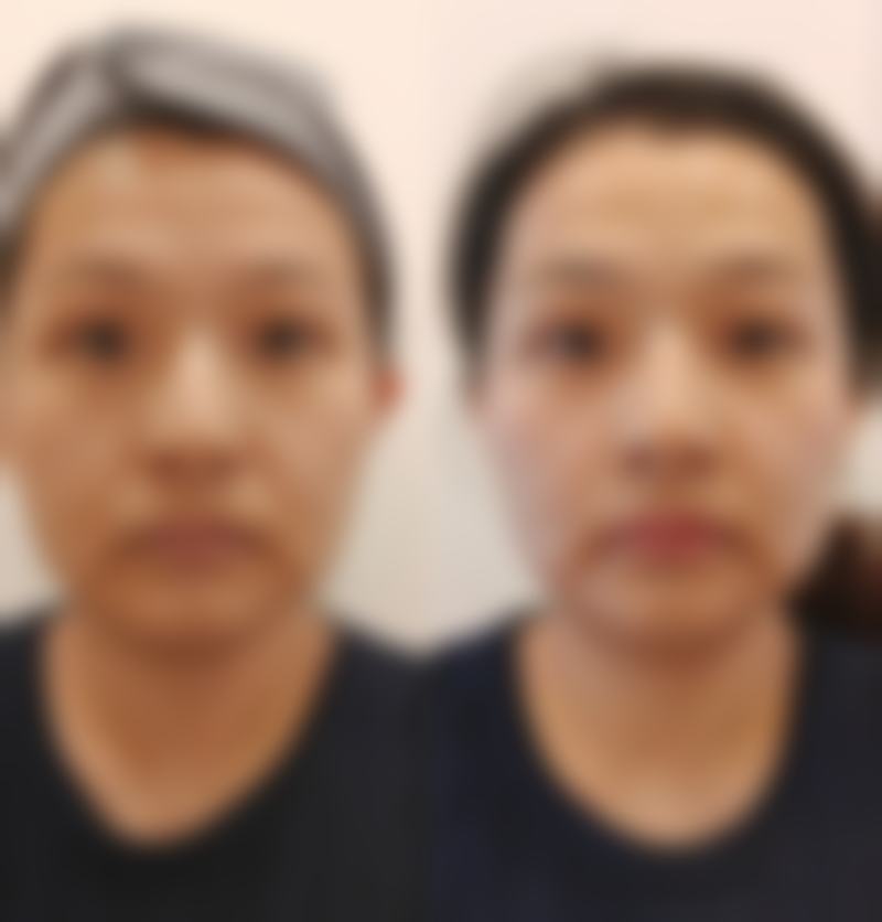 西安瑞丽整形美容医院价格收费