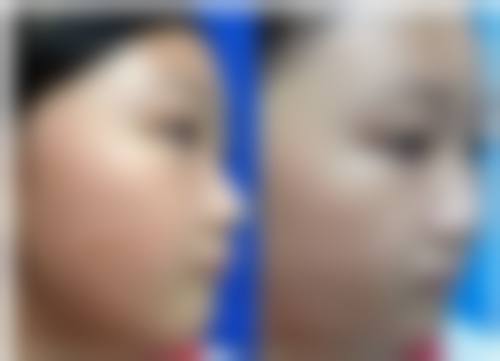 韩国Mauve车柄勋整形外科的就诊环境与服务
